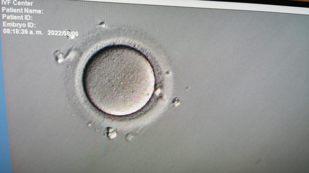 Nutrición ovulatoria: conoce los alimentos que te ayudarán a mejorar la calidad de tus óvulos